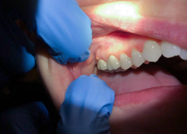 Best Emergency Dental Services for Seniors in Far Hills, NJ