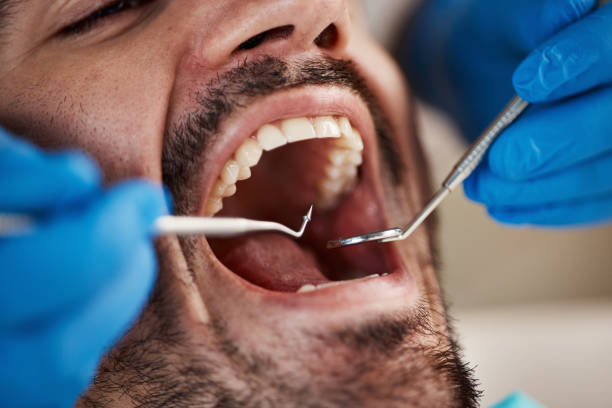 Best Emergency Dentist for Knocked-Out Tooth in Far Hills, NJ