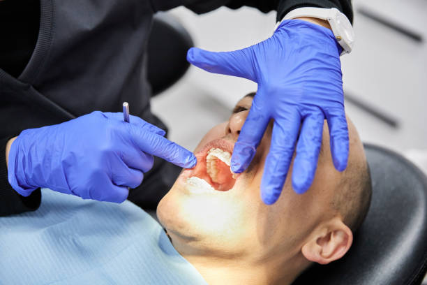 Best Emergency Dental Extractions in Far Hills, NJ